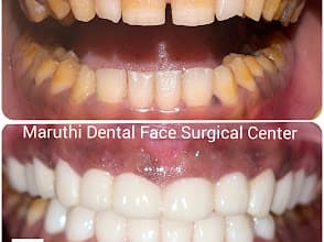 MARUTHI DENTAL photo